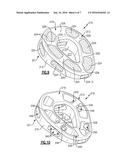 SURGICAL IMPLANT WITH POROUS REGION diagram and image