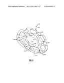 SURGICAL IMPLANT WITH POROUS REGION diagram and image