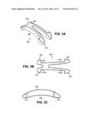 SCLERAL PROSTHESIS FOR TREATING PRESBYOPIA AND OTHER EYE DISORDERS AND     RELATED DEVICES AND METHODS diagram and image