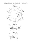 INTRAOCULAR LENS diagram and image