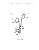 Interlaminar Fixation Device diagram and image