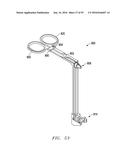 Interlaminar Fixation Device diagram and image