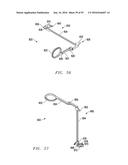 Interlaminar Fixation Device diagram and image