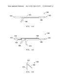 Interlaminar Fixation Device diagram and image