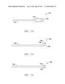 Interlaminar Fixation Device diagram and image