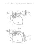 DEVICE FOR TREATING OBESITY diagram and image