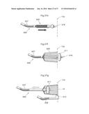 DEVICE FOR TREATING OBESITY diagram and image