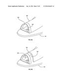 DEVICES AND METHODS FOR NASAL SPLINTING diagram and image