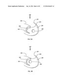 DEVICES AND METHODS FOR NASAL SPLINTING diagram and image