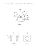 DEVICES AND METHODS FOR NASAL SPLINTING diagram and image