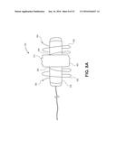 OCCLUSION DEVICE WITH OPENABLE CHANNEL diagram and image