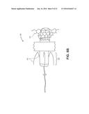 OCCLUSION DEVICE WITH OPENABLE CHANNEL diagram and image