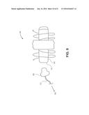 OCCLUSION DEVICE WITH OPENABLE CHANNEL diagram and image