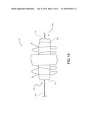 OCCLUSION DEVICE WITH OPENABLE CHANNEL diagram and image