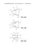 OCCLUSION DEVICE WITH OPENABLE CHANNEL diagram and image