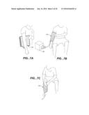 MODULAR APPARATUS FOR THERAPY OF AN ANIMATE BODY diagram and image