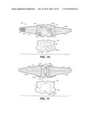 MODULAR APPARATUS FOR THERAPY OF AN ANIMATE BODY diagram and image