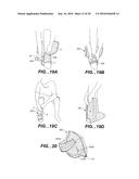 MODULAR APPARATUS FOR THERAPY OF AN ANIMATE BODY diagram and image