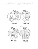 MODULAR APPARATUS FOR THERAPY OF AN ANIMATE BODY diagram and image