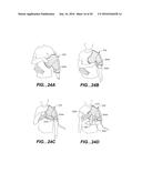 MODULAR APPARATUS FOR THERAPY OF AN ANIMATE BODY diagram and image