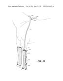 MODULAR APPARATUS FOR THERAPY OF AN ANIMATE BODY diagram and image