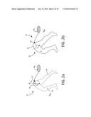 BODY LIFT-ASSIST WALKER DEVICE diagram and image