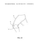 BODY LIFT-ASSIST WALKER DEVICE diagram and image