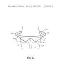 BODY LIFT-ASSIST WALKER DEVICE diagram and image