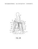 BODY LIFT-ASSIST WALKER DEVICE diagram and image