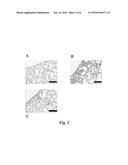 TREATMENT OF PULMONARY FIBROSIS USING AN INHIBITOR OF CBP/CATENIN diagram and image