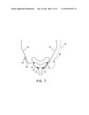 HEADGEAR FOR PATIENT INTERFACE diagram and image