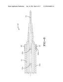 BALLOON CATHETER HAVING A RETRACTABLE SHEATH AND LOCKING MECHANISM diagram and image