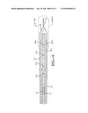 BALLOON CATHETER HAVING A RETRACTABLE SHEATH AND LOCKING MECHANISM diagram and image