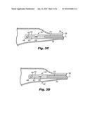 METHODS AND DEVICES FOR TREATING SINUSITIS diagram and image