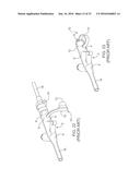 LOCKING DEVICE FOR A Y-PORT FEEDING ADAPTER diagram and image