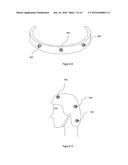 WEARABLE MAGNETIC DEVICE AND METHOD FOR SUBJECTING A BODY REGION TO A     MAGNETIC FIELD diagram and image