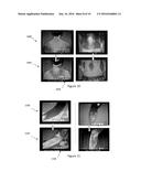 WEARABLE MAGNETIC DEVICE AND METHOD FOR SUBJECTING A BODY REGION TO A     MAGNETIC FIELD diagram and image