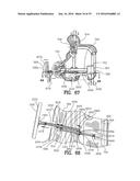 Exercising Apparatus diagram and image