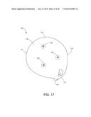 RELEASABLE COMPONENTS FOR A GOLF CLUB diagram and image