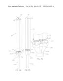 COALESCING FILTER SEPARATION SYSTEM AND METHOD diagram and image