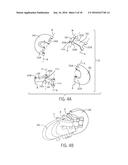 LINEAR DERAILLEUR MECHANISM diagram and image