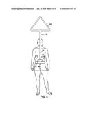 MARKER AND RECOVERY DEVICE diagram and image