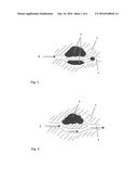 METHOD FOR PRODUCING MINERAL OIL FROM AN UNDERGROUND MINERAL OIL DEPOSIT     USING A COMPOSITION (Z) COMPRISING A GLYCEROL-BORIC ACID COMPLEX diagram and image