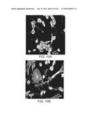 ISOLATION, EXPANSION AND USE OF CLONOGENIC ENDOTHELIAL PROGENITOR CELLS diagram and image