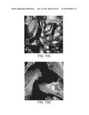 ISOLATION, EXPANSION AND USE OF CLONOGENIC ENDOTHELIAL PROGENITOR CELLS diagram and image