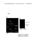 BACTERIAL HYALURONIDASE AND PROCESS FOR ITS PRODUCTION diagram and image