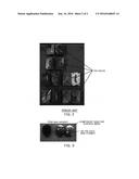 METHOD FOR MANUFACTURING DUPLEX STAINLESS STEEL SHEET HAVING REDUCED     INCLUSIONS diagram and image