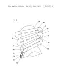 INFLATABLE BLAST-INDUCED BRAIN INJURY PREVENTION DEVICE diagram and image