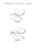 IMAGING SYSTEM WITH ELECTROPHOTOGRAPHIC PATTERNING OF AN IMAGE DEFINITION     MATERIAL AND METHODS THEREFOR diagram and image