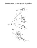 ENDOSCOPE WITH SHARED WORKING CHANNEL diagram and image